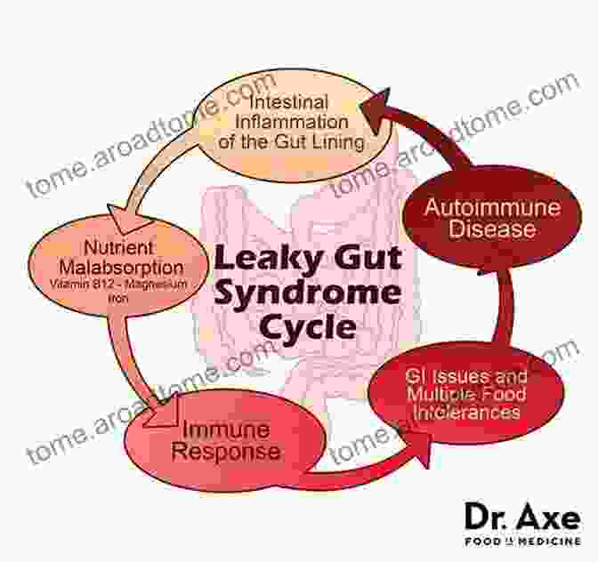 A Graphic Illustration Depicting The Concept Of Leaky Gut Syndrome, Where The Intestinal Lining Is Compromised, Allowing Toxins And Pathogens To Enter The Bloodstream. Ibuprofen Side Effects: Bleeding Ulcers Are Just The Beginning