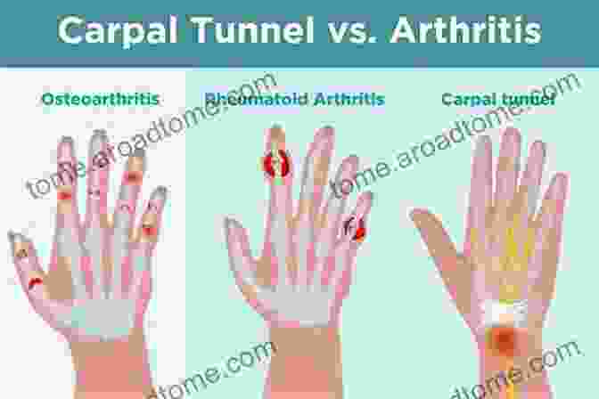 Different Types Of Arthritis Affecting Joints Arthritis And Common Sense Dale Alexander