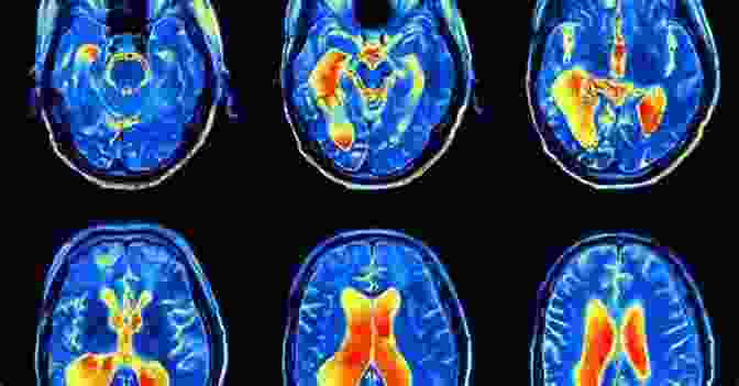 Functional MRI Scan Of The Human Brain, Revealing Neural Activity Patterns Associated With Different Behaviors. A Foundational Explanation Of Human Behavior