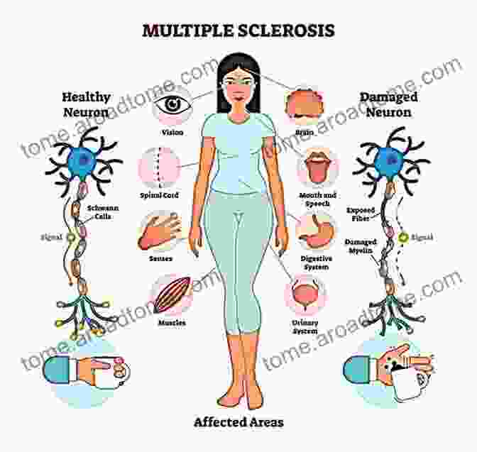 The Biology Of Multiple Sclerosis: Cambridge Medicine Hardcover The Biology Of Multiple Sclerosis (Cambridge Medicine (Hardcover))