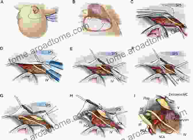 The Network Approach In Neurosurgery: Unlocking The Power Of Connections Epilepsy Surgery: The Network Approach An Issue Of Neurosurgery Clinics Of North America E (The Clinics: Surgery)