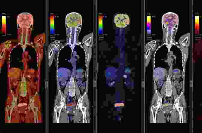 Various Tomographic Imaging Techniques, Including CT, MRI, And PET Scans, Provide Valuable Insights Into The Human Body's Structure And Function. Machine Learning For Tomographic Imaging (IPEM IOP In Physics And Engineering In Medicine And Biology)