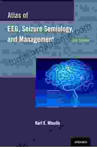 Atlas Of EEG Seizure Semiology And Management