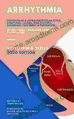 Arrhythmia: Dysrhythmia Irregular Heartbeat Tachycardia (Arrhythmia Types Causes Symptoms Diagnosis Treatment Risk Factors Prevention 1)